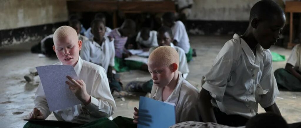 Tanzanians hard hit by trafficking in people with albinism