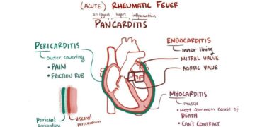 Volunteers Screen for Rheumatic Heart Disease among Children in Micronesia – Adventist Review