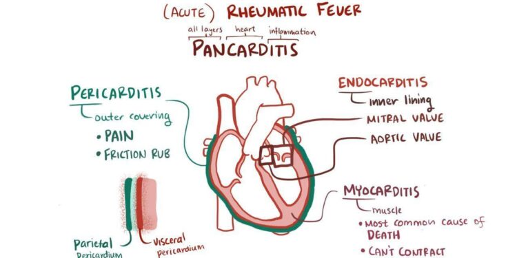 Volunteers Screen for Rheumatic Heart Disease among Children in Micronesia – Adventist Review