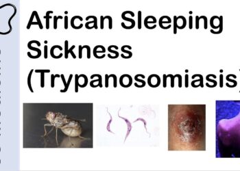 East African Sleeping Sickness in Zambia and Zimbabwe – Centers for Disease Control and Prevention (.gov)
