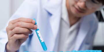 XponentL Data Announces the Strategic Acquisition of SmartBits, Switzerland – Business Wire