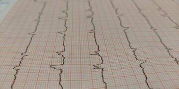 Suspected Jihadist Attack Kills ‘Several Dozen’ Soldiers in Burkina – The Defense Post