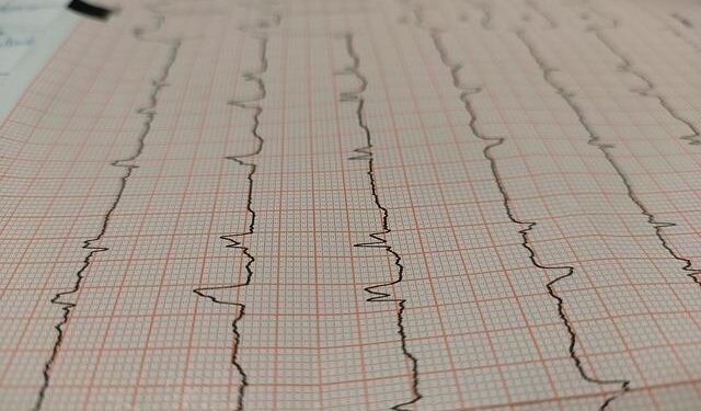 Suspected Jihadist Attack Kills ‘Several Dozen’ Soldiers in Burkina – The Defense Post