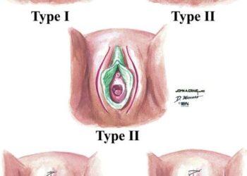 The 96-Year-Old Who Defied a Ban on Female Genital Cutting – The New York Times