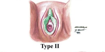 The 96-Year-Old Who Defied a Ban on Female Genital Cutting – The New York Times