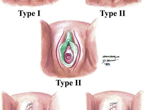 The 96-Year-Old Who Defied a Ban on Female Genital Cutting – The New York Times