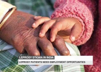 Patients with leprosy face lasting stigma in Ethiopia – WyomingNews.com