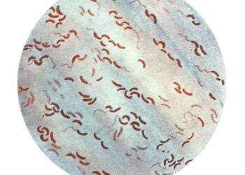 Genomic insights into the 2022– 2023Vibrio cholerae outbreak in Malawi – Nature