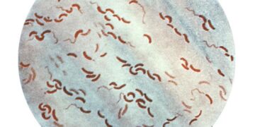 Genomic insights into the 2022– 2023Vibrio cholerae outbreak in Malawi – Nature