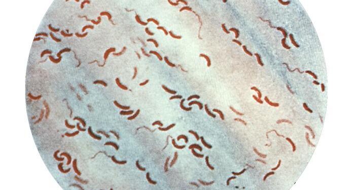 Genomic insights into the 2022– 2023Vibrio cholerae outbreak in Malawi – Nature