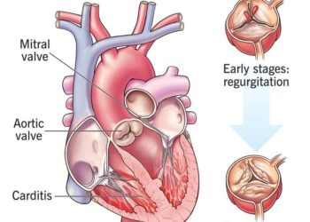 Rheumatic Heart Disease: Easing the Burden in Cape Verde – Mass General Giving
