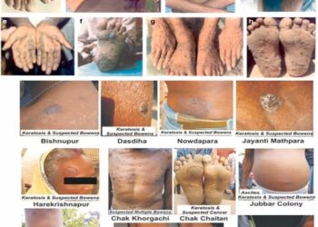 Health Alert – U.S. Embassy, Lusaka, Zambia: Acute Heavy Metal Poisoning – U.S. Embassy in Zambia (.gov)