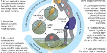15 Guinea Worm Cases Reported Last Year – The Carter Center