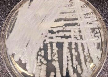 Multidrug-resistant yeast cases rising rapidly in Europe, survey shows – CIDRAP