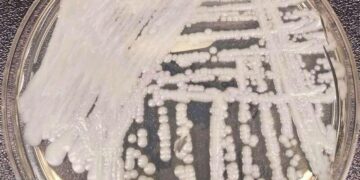 Multidrug-resistant yeast cases rising rapidly in Europe, survey shows – CIDRAP