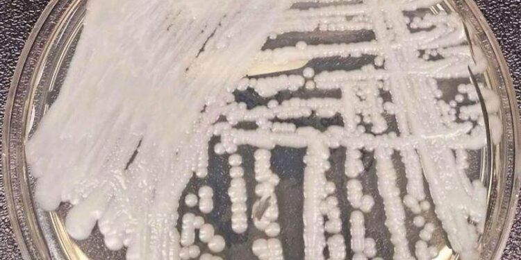 Multidrug-resistant yeast cases rising rapidly in Europe, survey shows – CIDRAP