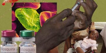 Burundi introduces malaria vaccine into routine immunization – Gavi, the Vaccine Alliance