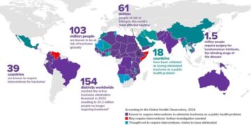 Burundi eliminates trachoma as a public health problem – World Health Organization (WHO)