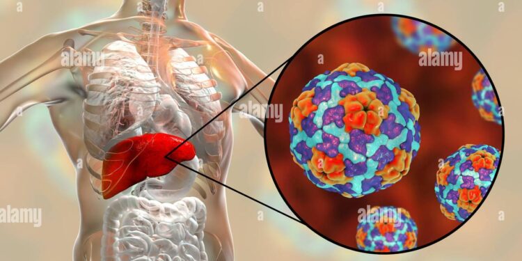 Hepatitis A in the Czech Republic: Cases continue to rise, Prague accounts for some 40% of total – Outbreak News Today