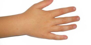 Exploring the Human Rights Consequences of Nuclear Testing in the Marshall Islands