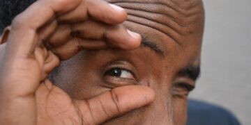 Unveiling the Healthcare Struggles in Somalia and Somaliland: An In-Depth Exploration