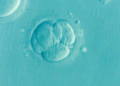 IVF Controversy: Parents Accuse Clinics of Misleading Information on Sperm and Egg Donors in Northern Cyprus