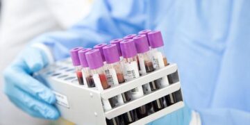 Startling Revelation: TFA Detected in Every Blood Sample from 110 Europeans!