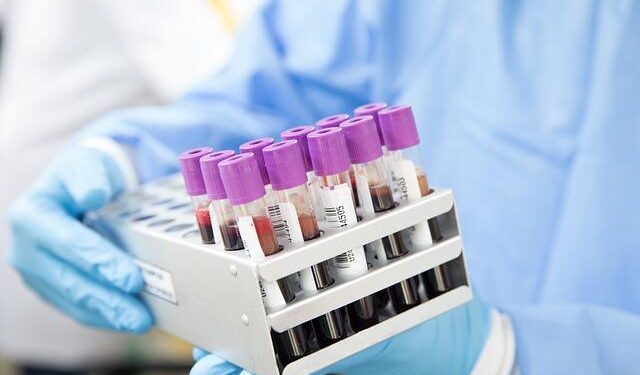 Startling Revelation: TFA Detected in Every Blood Sample from 110 Europeans!